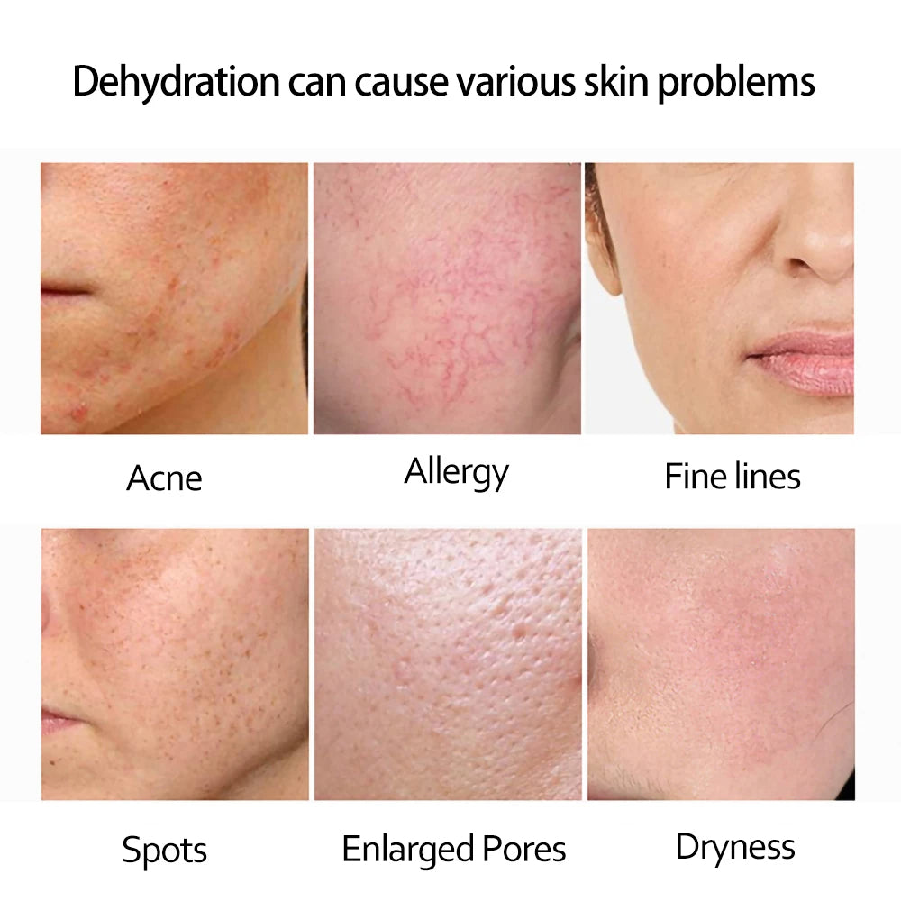 Sérum à l'acide hyaluronique doré 24K pour le visage