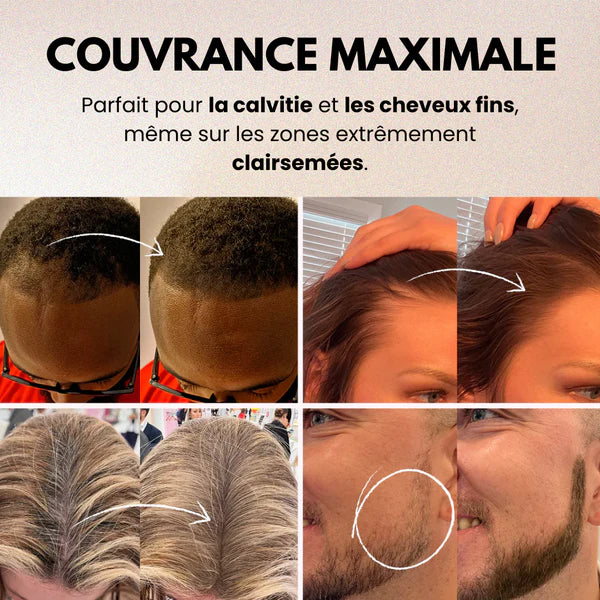 Fibres Capillaires pour la Perte de Cheveux