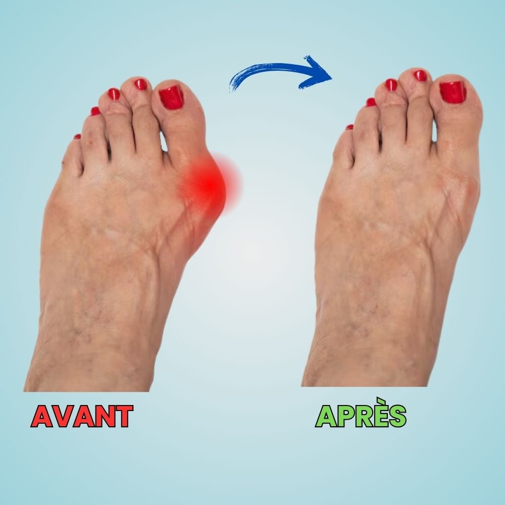 Semelles OrthoFlex - Coussinets de chaussures