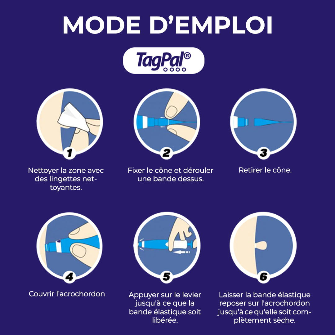 Skin Tag Removal Kit