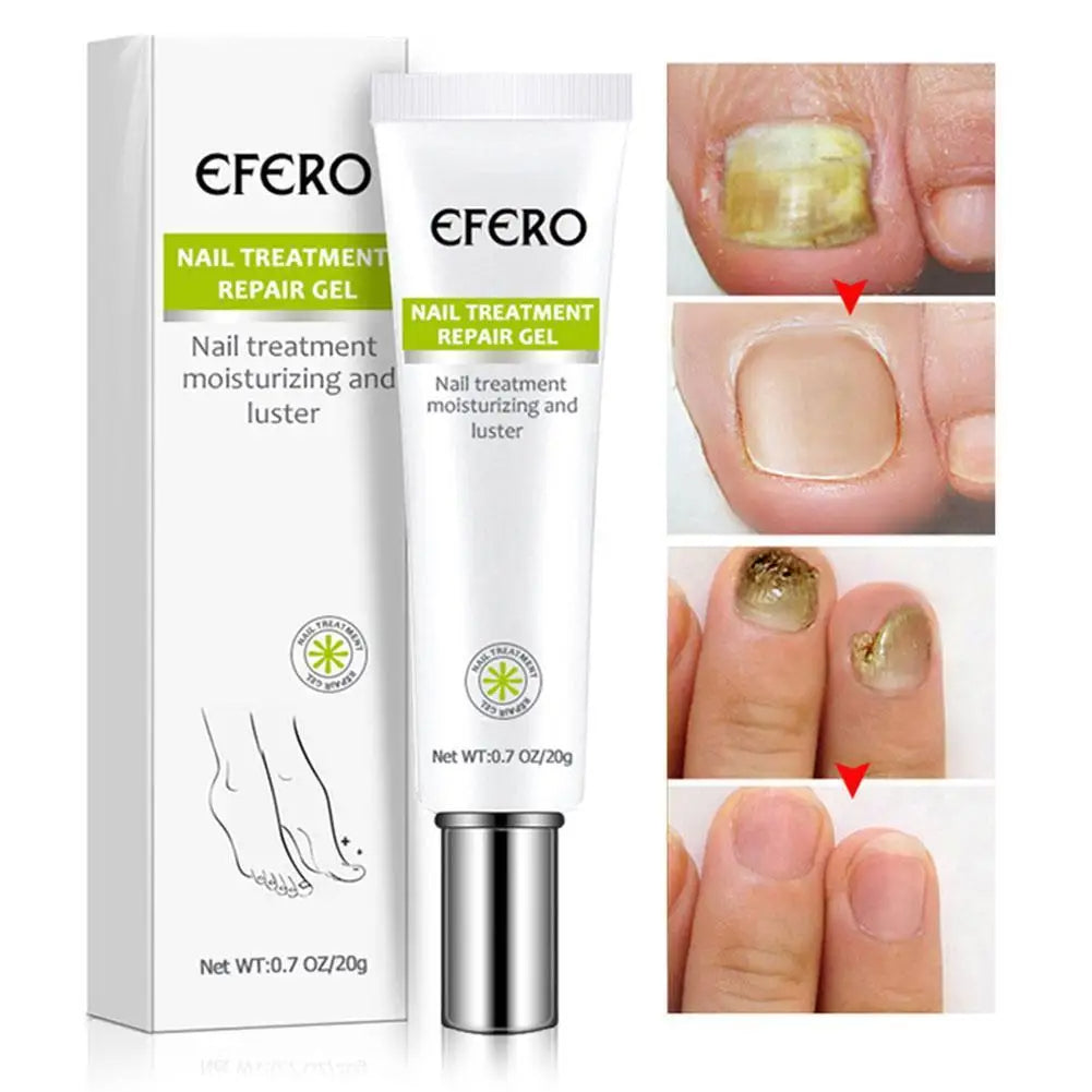 Crème Réparatrice pour Ongles
