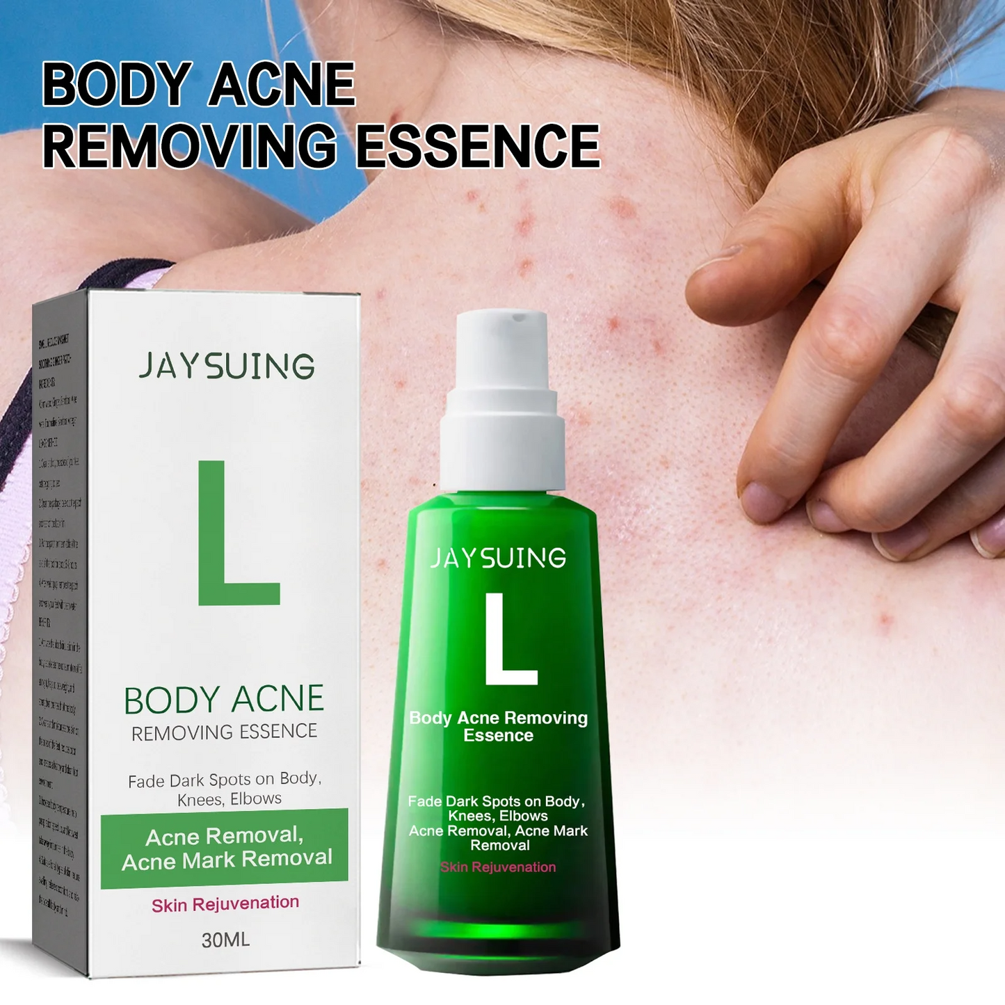 Sérum Anti-Acne