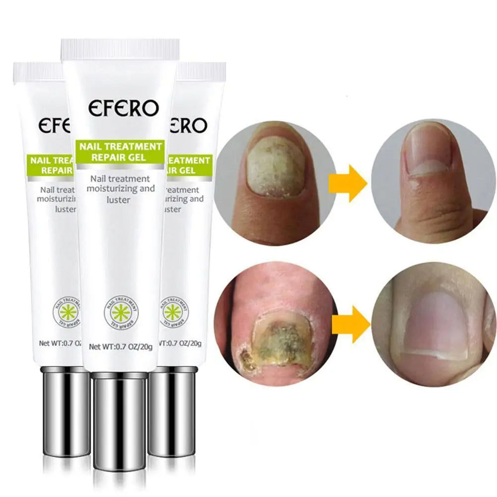 Crème Réparatrice pour Ongles