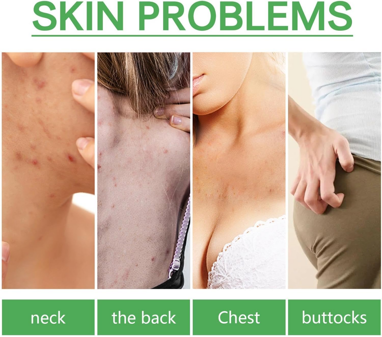 Sérum Anti-Acne