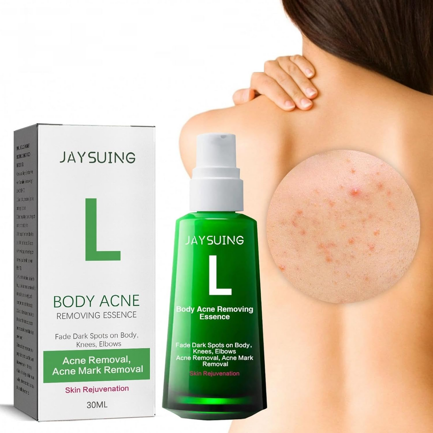 Sérum Anti-Acne