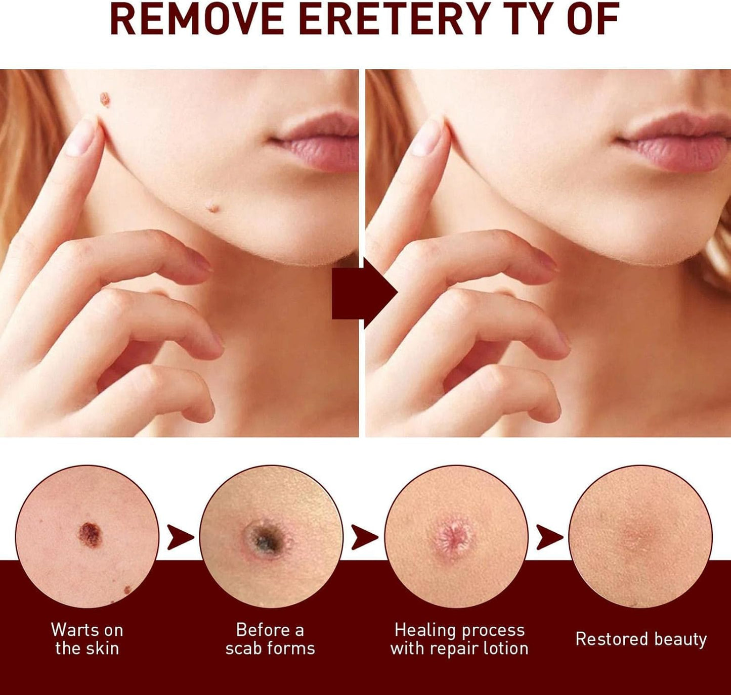 Le Dissolvant d'étiquettes