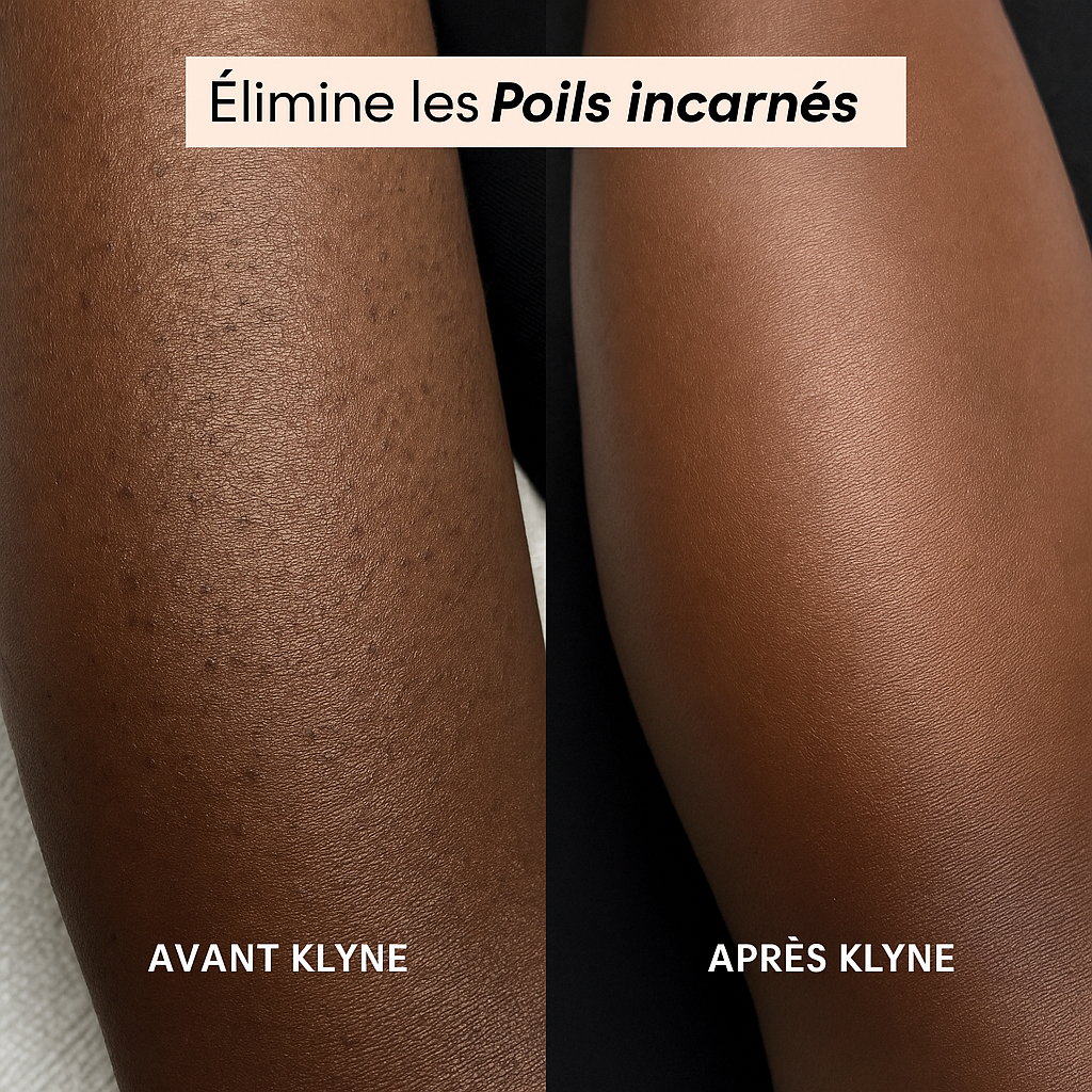 Rasoir Électrique Femme 2-en-1 – Waterproof & Rechargeable | Doux & Sans Douleur