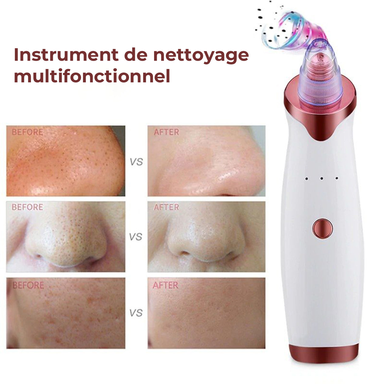 Aspirateur de Points Noirs et Lifting Facial