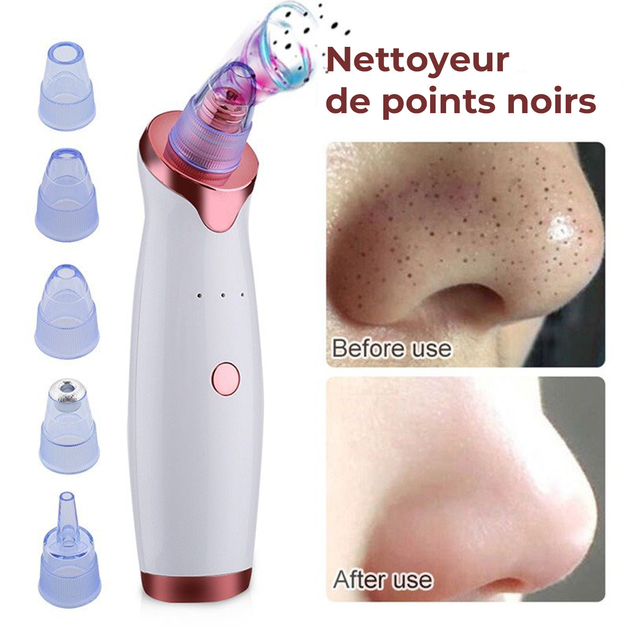 Aspirateur de Points Noirs et Lifting Facial