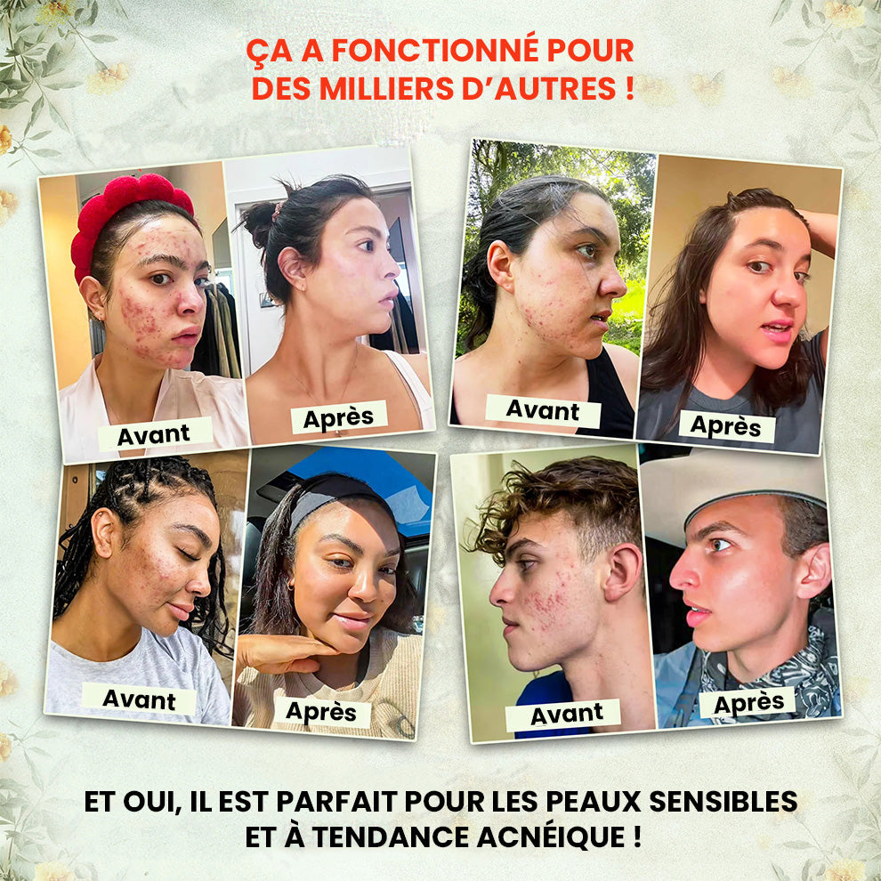 Baume au Suif tout -en-1 – Anti-acné, anti-rides, hydratation longue durée