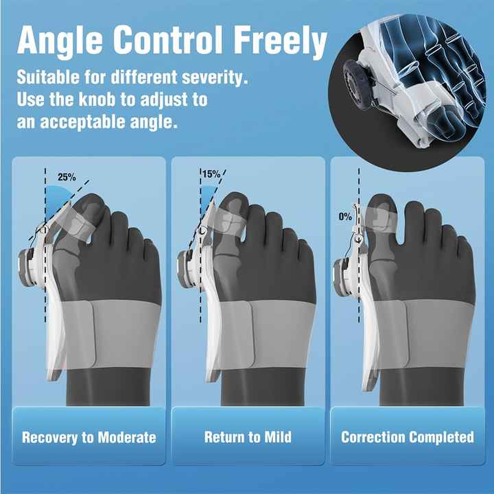 Correcteur Orthopédique pour Hallux Valgus