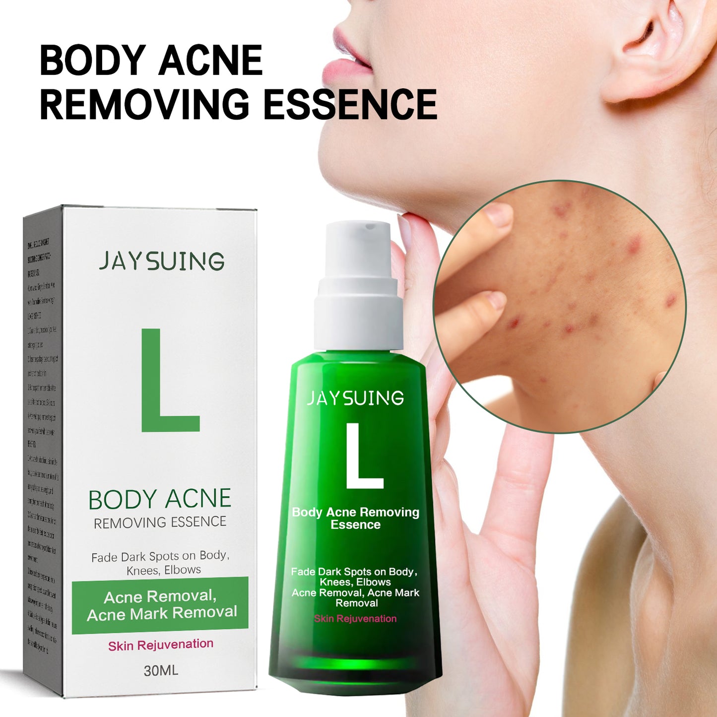 Sérum Anti-Acne