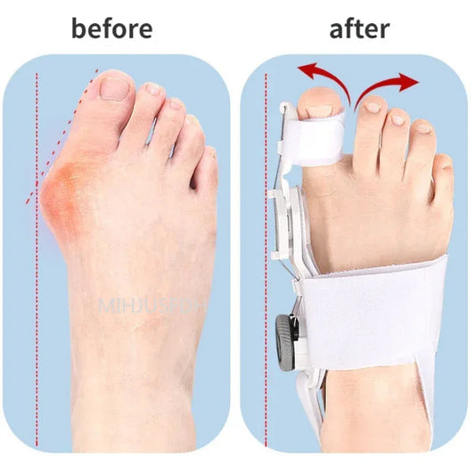 Correcteur Orthopédique pour Hallux Valgus