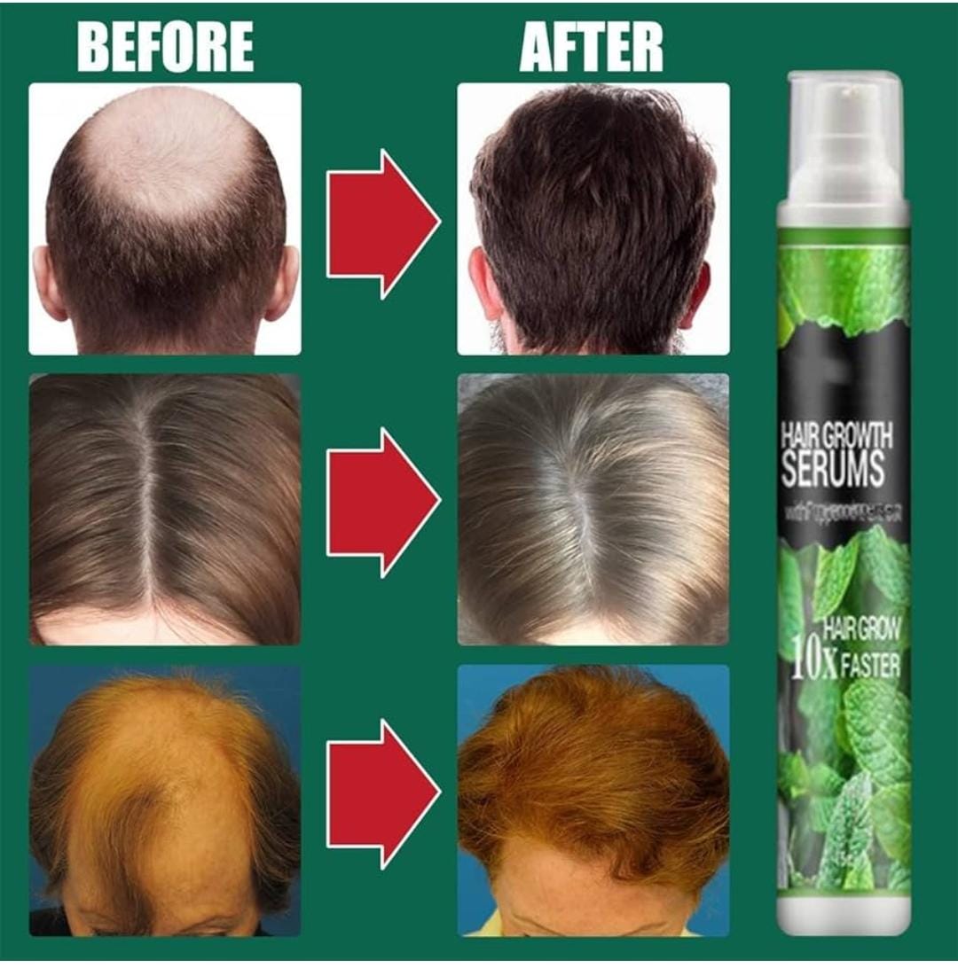 Sérum Spray pour la Croissance des Cheveux South Moon