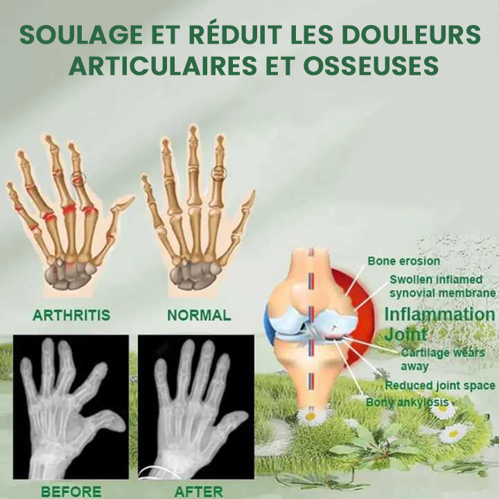 Spray Herbal pour soulager les douleurs articulaires