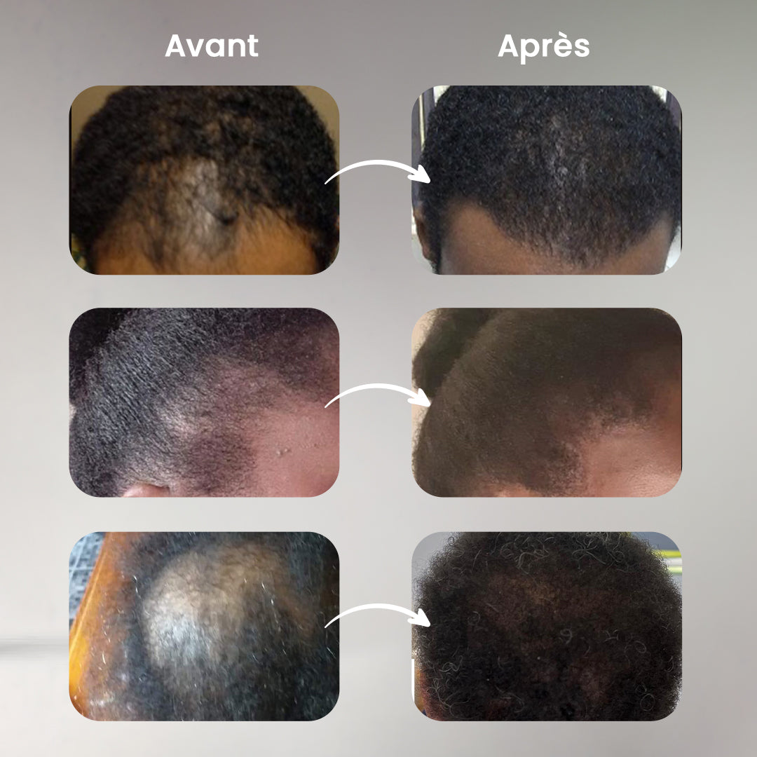 FullHair Pro - Fibres capillaires des cheveux