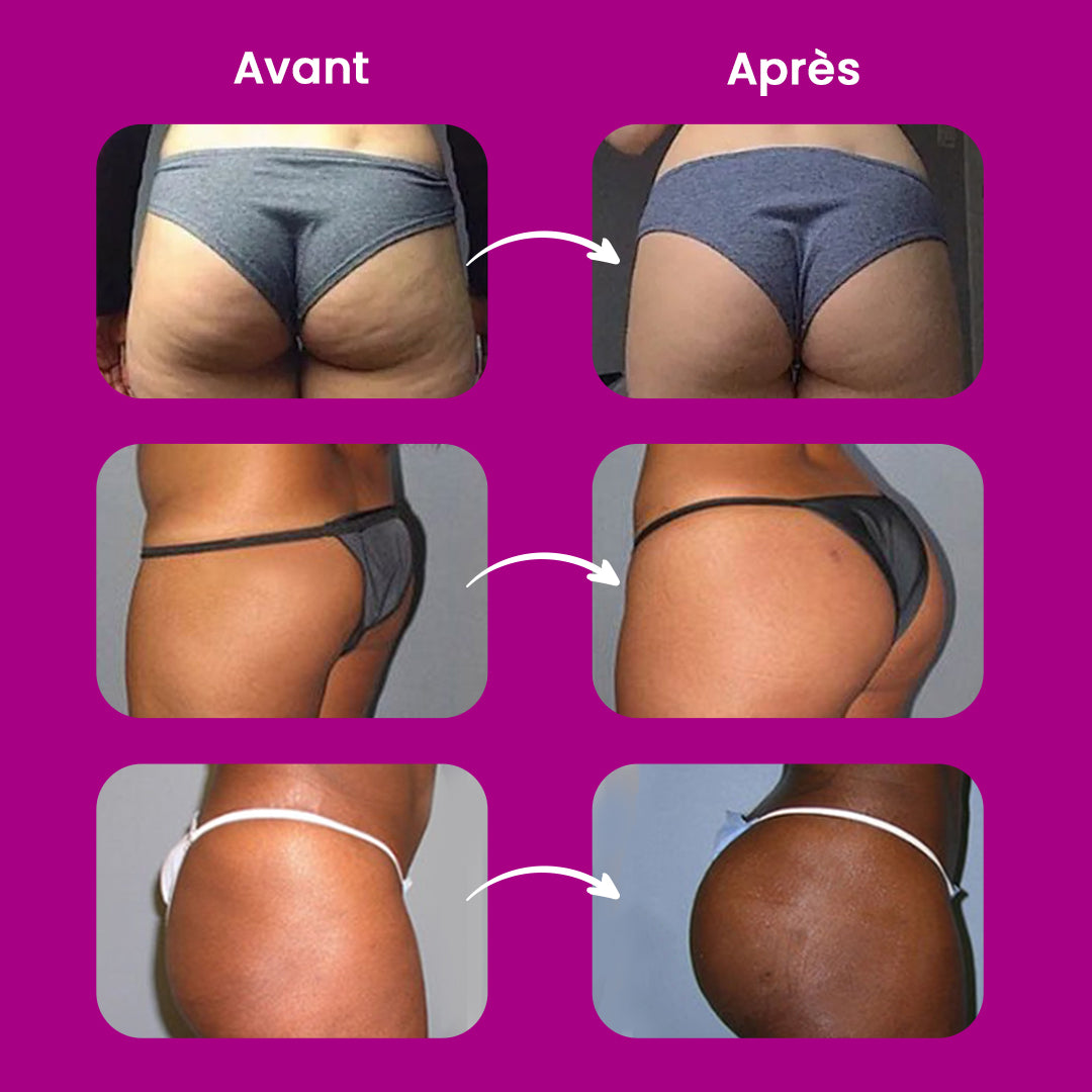 Crème pour l'agrandissement des fesses