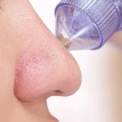 Aspirateur de Points Noirs et Lifting Facial