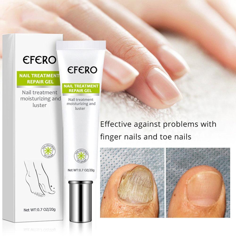 Crème Réparatrice pour Ongles