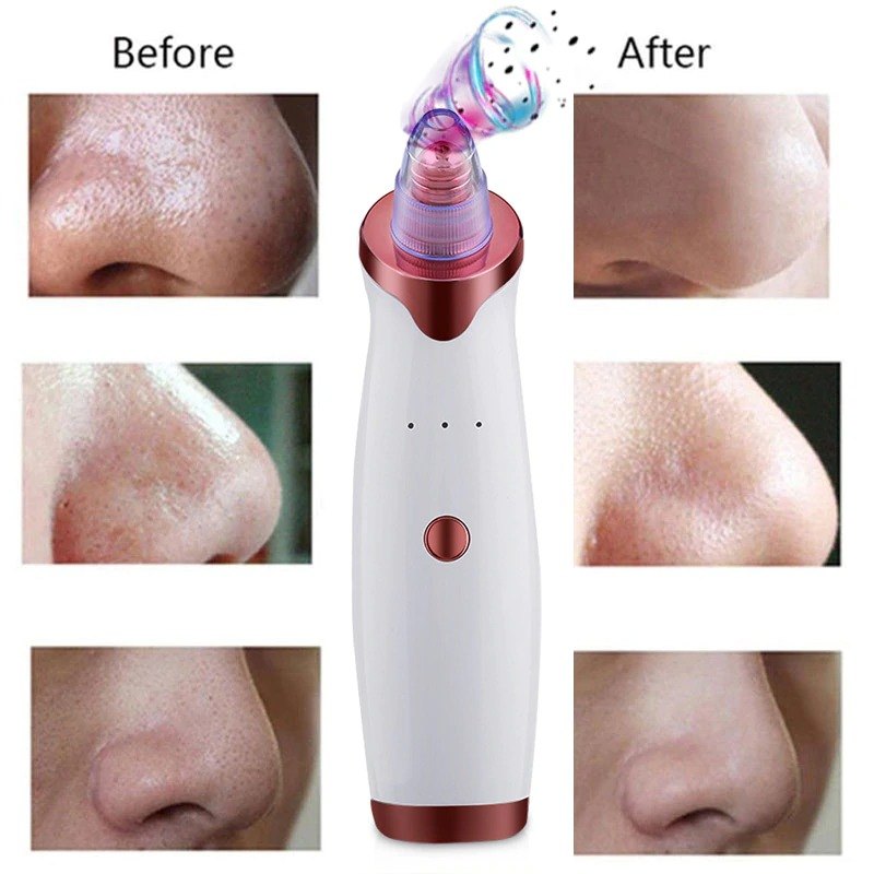 Aspirateur de Points Noirs et Lifting Facial