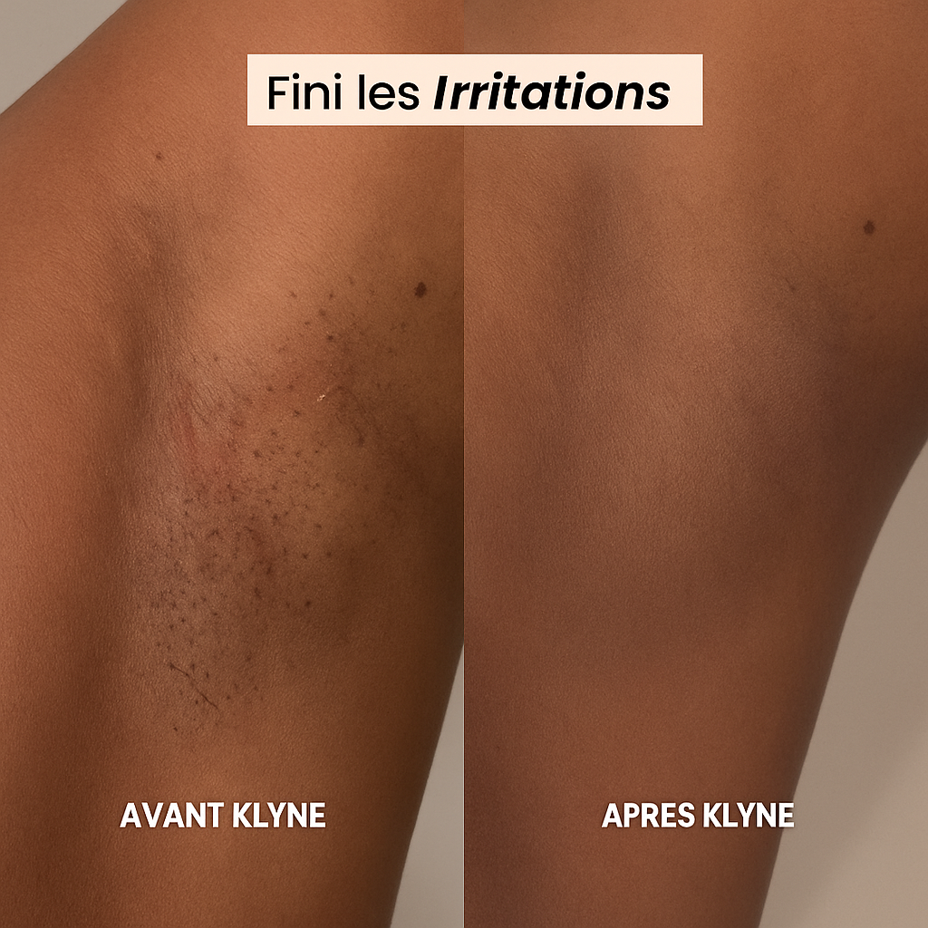 Rasoir Électrique Femme 2-en-1 – Waterproof & Rechargeable | Doux & Sans Douleur