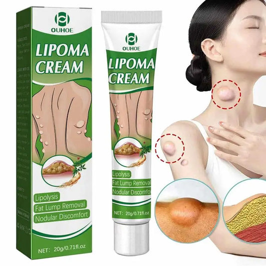 Crème d'Élimination des Graisses et Lipomes