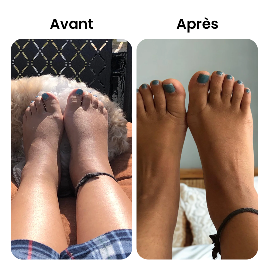 EMSense™ – Massager de Pieds Triple Thérapie