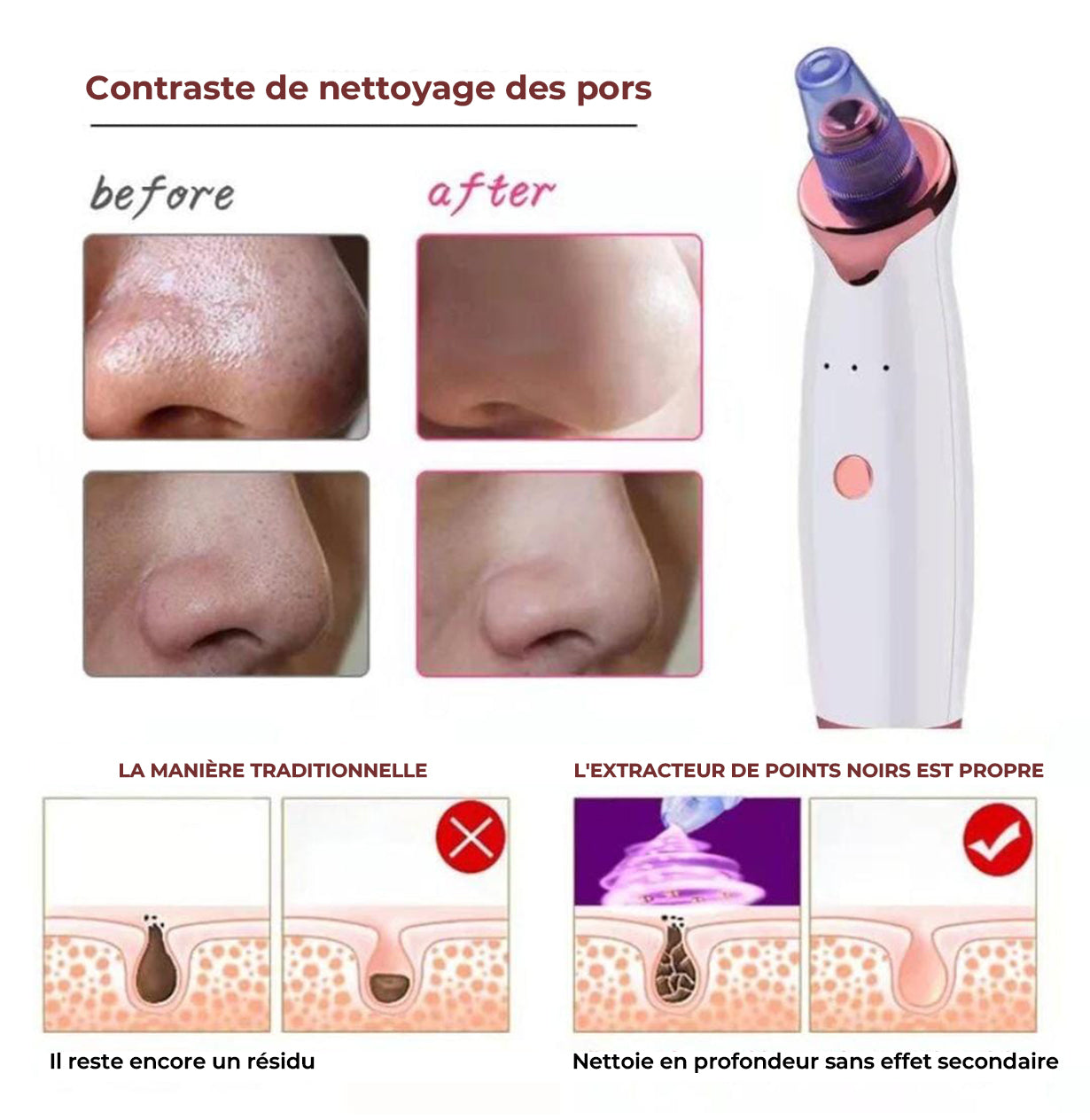 Aspirateur de Points Noirs et Lifting Facial