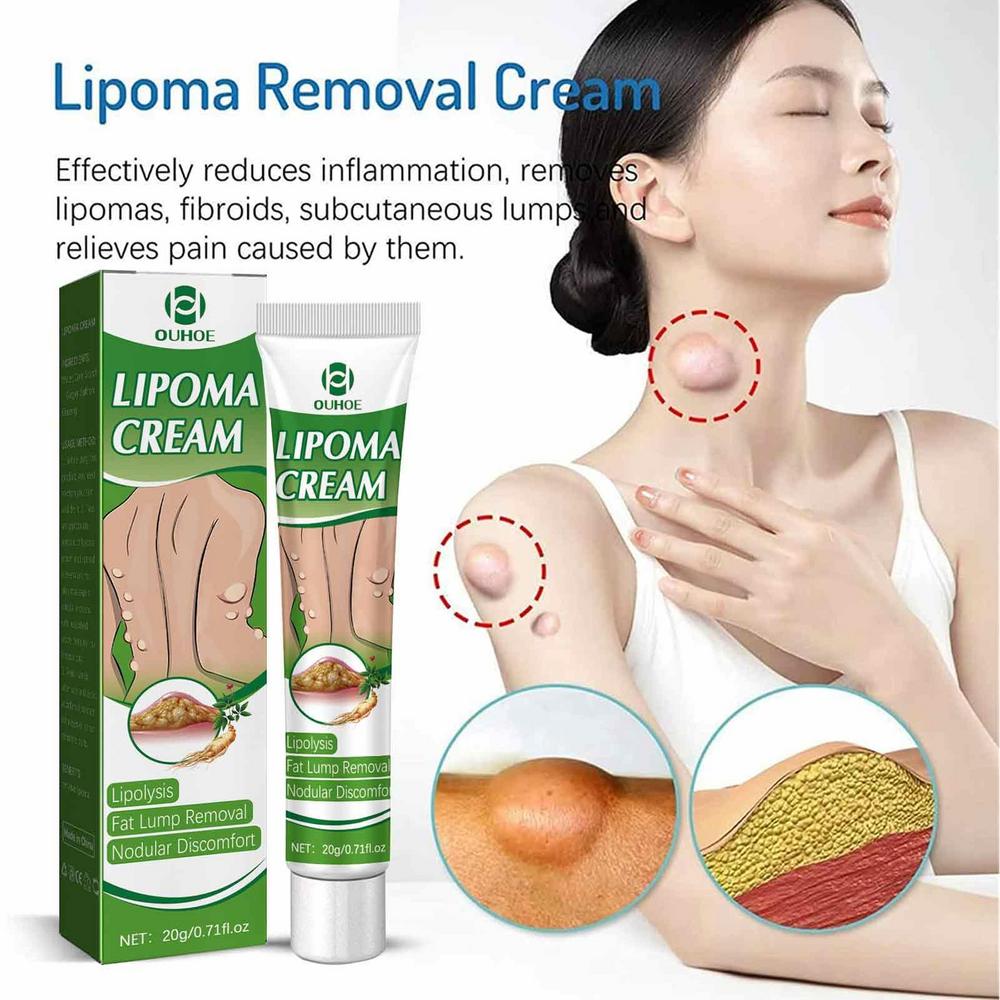 Crème d'Élimination des Graisses et Lipomes