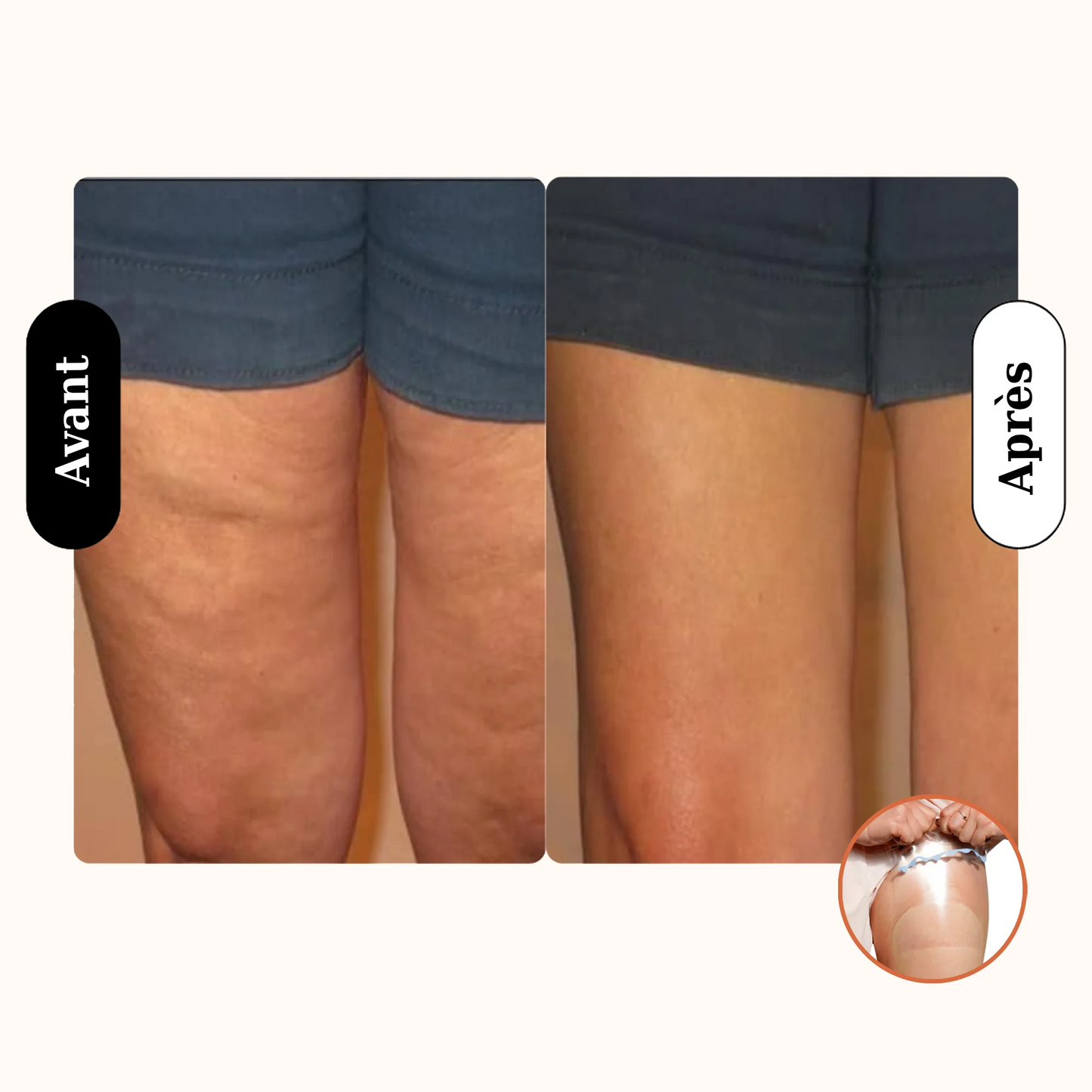 LiftiSecret - Patchs invisibles liftants