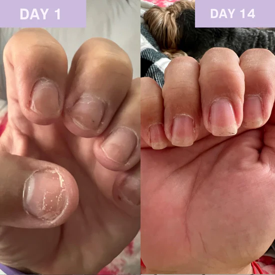 Gel Renaissance Ongles au Keratin
